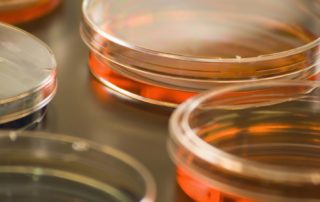 MacConkey Agar Plates- Know Your Media