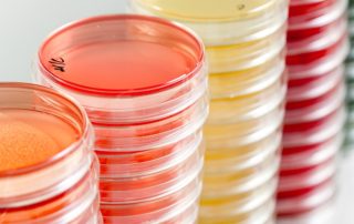 Potato Dextrose Agar- Know Your Agar plates
