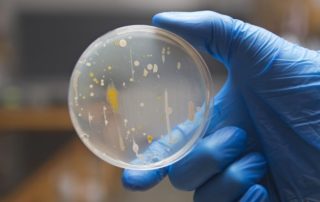 Inoculating Bacteria on Agar Plates by Streak-plating