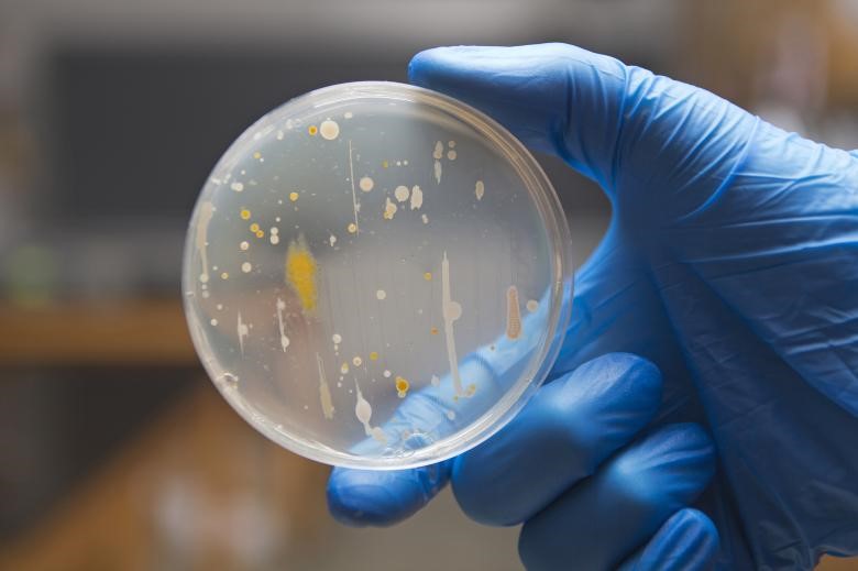 Inoculating Bacteria on Agar Plates by Streak-plating