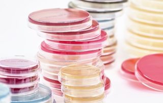 Nutrient Agar Plate - Know your media
