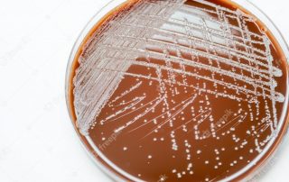 All About Chocolate Agar