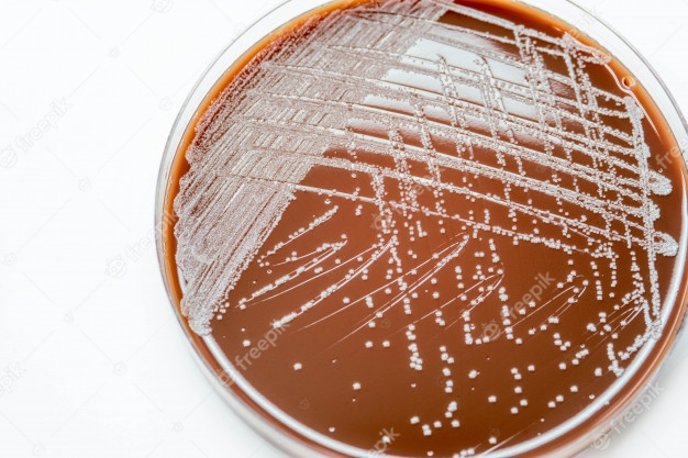 All About Chocolate Agar