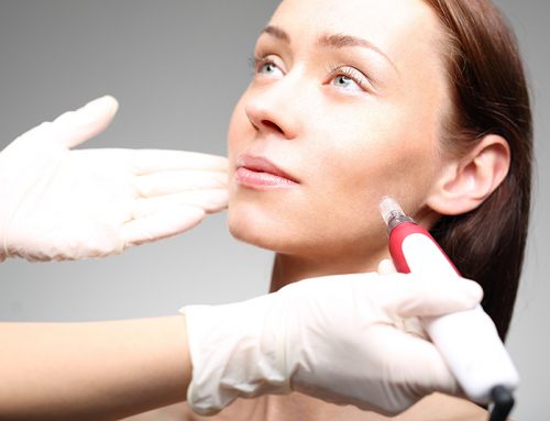 PLATELET RICH PLASMA: A Secret to Younger-Looking Skin?